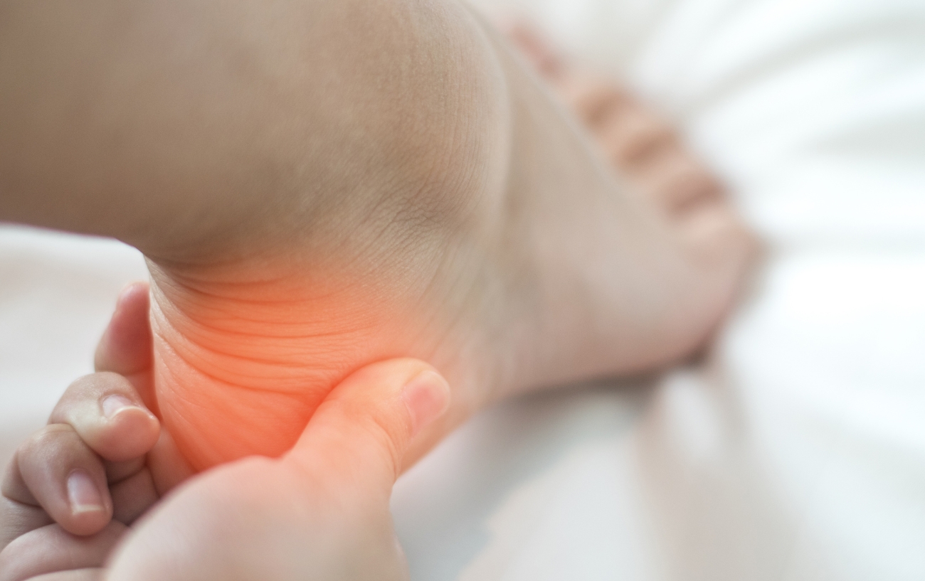 plantar fasciitis